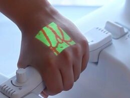 How Near-Infrared Imaging Technology is Improving the Patient Experience