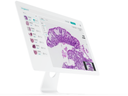 Imagene Raises $21.5M to Expand Image-Based Biomarker Detection for Precision Medicine