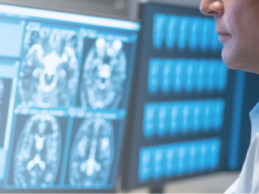 Nuance Launches Precision Imaging Network for AI-Powered Imaging Insights