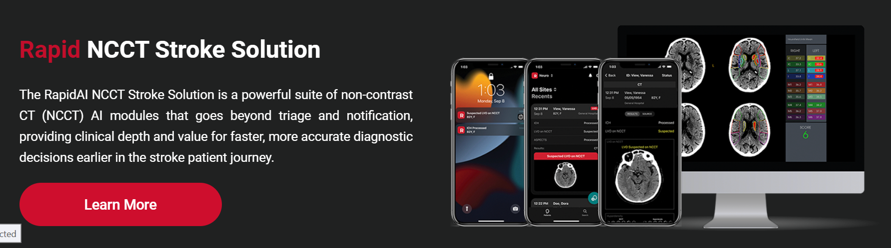 Missouri Hospital Taps RapidAI to Enhance Rural Stroke Care